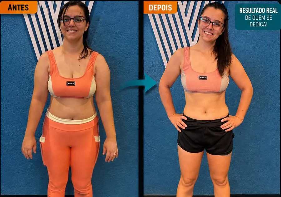 Aluna, antes e depois com redução de gordura
